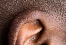 Hearing deterioration reported by discharged COVID-19 patients