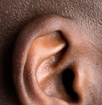 Hearing deterioration reported by discharged COVID-19 patients
