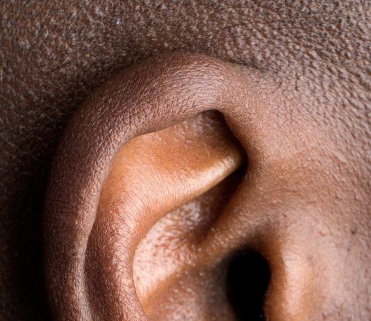 Hearing deterioration reported by discharged COVID-19 patients