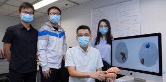 HKUST Researchers Uncover Chemo-resistance Mechanism in Glioma Patients