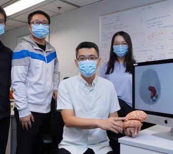 HKUST Researchers Uncover Chemo-resistance Mechanism in Glioma Patients