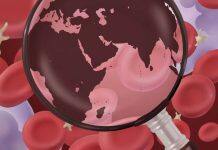 The genetics of blood: a global perspective