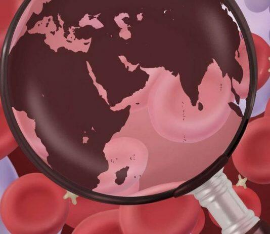 The genetics of blood: a global perspective