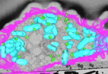 Fats fighting back against bacteria