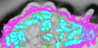 Fats fighting back against bacteria