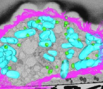 Fats fighting back against bacteria