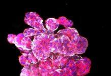 Monash discoveries suggest new breast cancer treatment