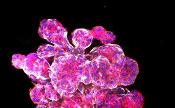 Monash discoveries suggest new breast cancer treatment