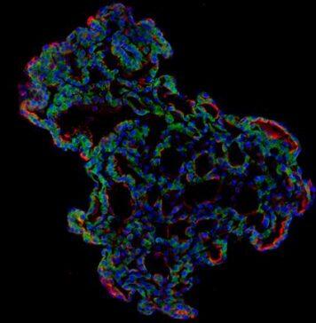 ‘Mini-lungs’ reveal early stages of SARS-CoV-2 infection