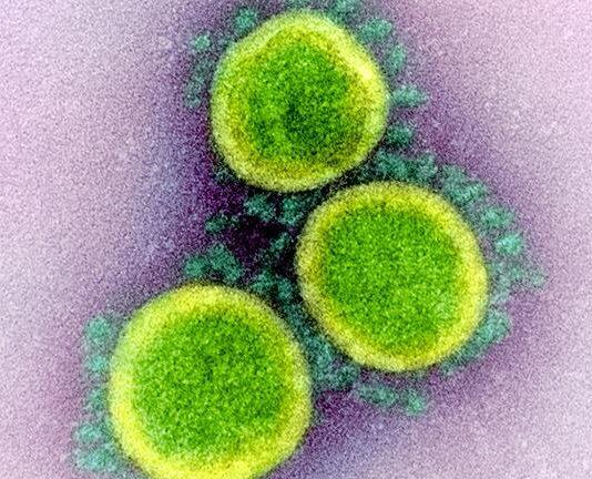 Cambridge-led SARS-CoV-2 genomic surveillance consortium receives £12.2 million