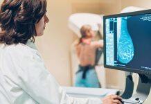New mammogram measures of breast cancer risk could revolutionise screening