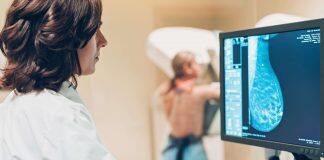 New mammogram measures of breast cancer risk could revolutionise screening