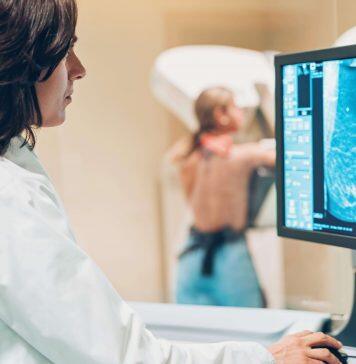 New mammogram measures of breast cancer risk could revolutionise screening