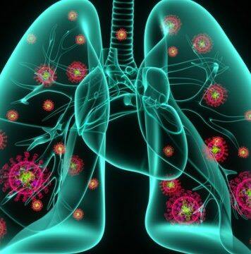 Why COVID-19 pneumonia lasts longer, causes more damage than typical pneumonia