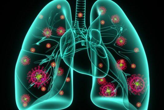 Why COVID-19 pneumonia lasts longer, causes more damage than typical pneumonia