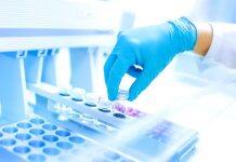 Oxford coronavirus vaccine produces strong immune response in older adults