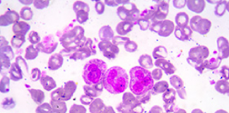 Targeted elimination of leukemic stem cells