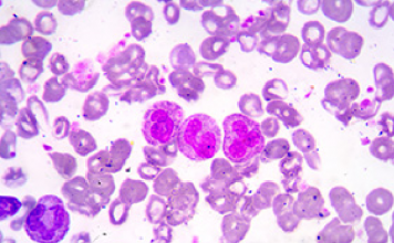 Targeted elimination of leukemic stem cells