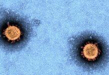 First antigen test pilot in low prevalence COVID-19 settings signals challenges for rollout
