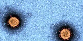 First antigen test pilot in low prevalence COVID-19 settings signals challenges for rollout