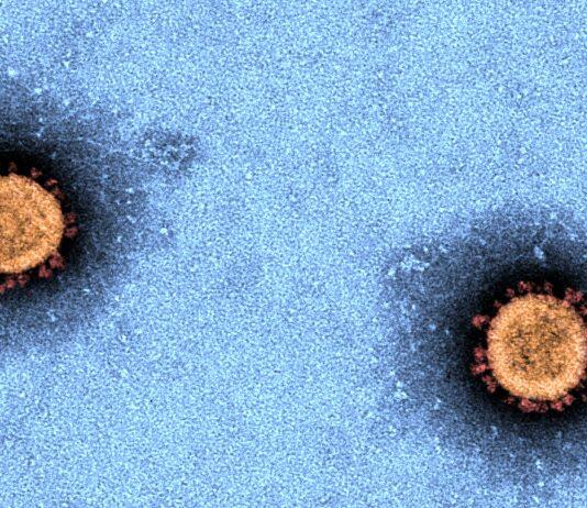 First antigen test pilot in low prevalence COVID-19 settings signals challenges for rollout