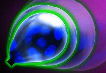 Membrane around tumors may be key to preventing metastasis