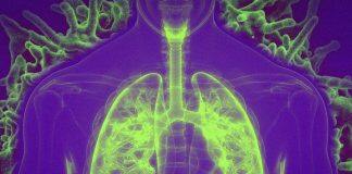 Vaccination by inhalation