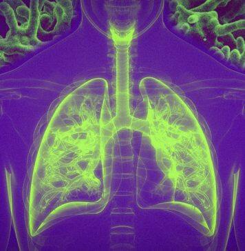 Vaccination by inhalation