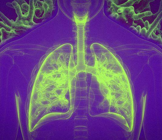 Vaccination by inhalation
