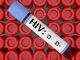 International HIV research to improve sexual and reproductive health of indigenous women and girls