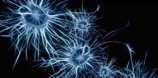 New Research Challenges Long-Held Theories of Alzheimer’s Disease Progerssion With Impact for Future Treatment