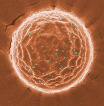 UChicago scientists design ‘nanotraps’ to catch and clear coronavirus from tissue