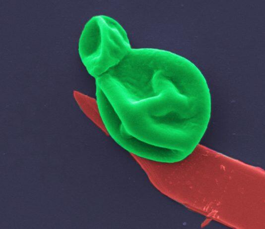 Superbug killer: New nanotech destroys bacteria and fungal cells