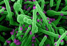 How accurate were early expert predictions on COVID-19, and how did they compare to the public?