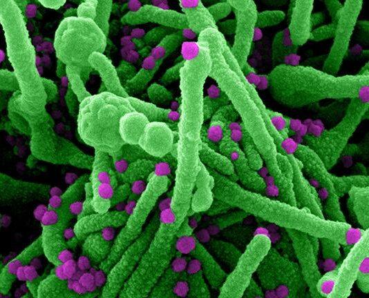 How accurate were early expert predictions on COVID-19, and how did they compare to the public?