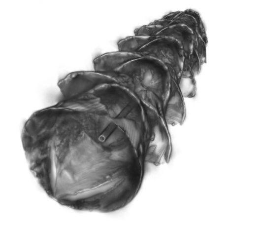 Stents inspired by paper-cutting art can deliver drugs to the GI tract