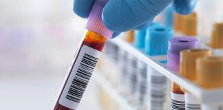 Can blood be used to predict age-related diseases? U of T researchers bet it can