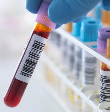 Can blood be used to predict age-related diseases? U of T researchers bet it can