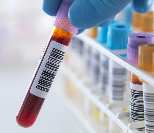 Can blood be used to predict age-related diseases? U of T researchers bet it can