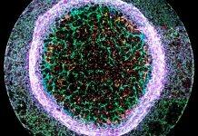 Bristol scientist beats competition to win national science image contest with heart vessel image