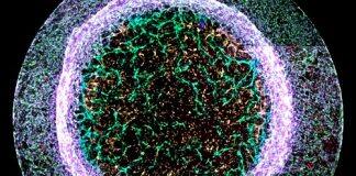 Bristol scientist beats competition to win national science image contest with heart vessel image