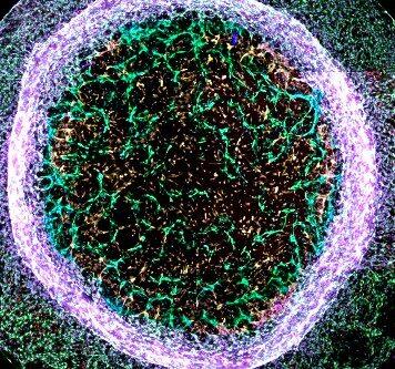 Bristol scientist beats competition to win national science image contest with heart vessel image