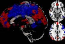 First research scans performed in BU’s MRI scanner