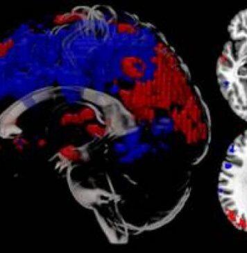 First research scans performed in BU’s MRI scanner