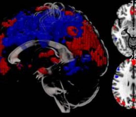 First research scans performed in BU’s MRI scanner
