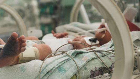 Reducing mechanical ventilation improves outcomes for critically ill children