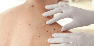 World-first 3D imaging for melanoma detection