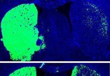 UC San Diego-Led Team Receives $9M to Advance Parkinson’s Disease Treatments