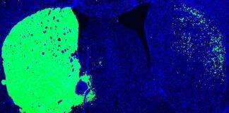 UC San Diego-Led Team Receives $9M to Advance Parkinson’s Disease Treatments