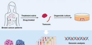 UM makes breakthrough in precision medicine treatment for breast cancer